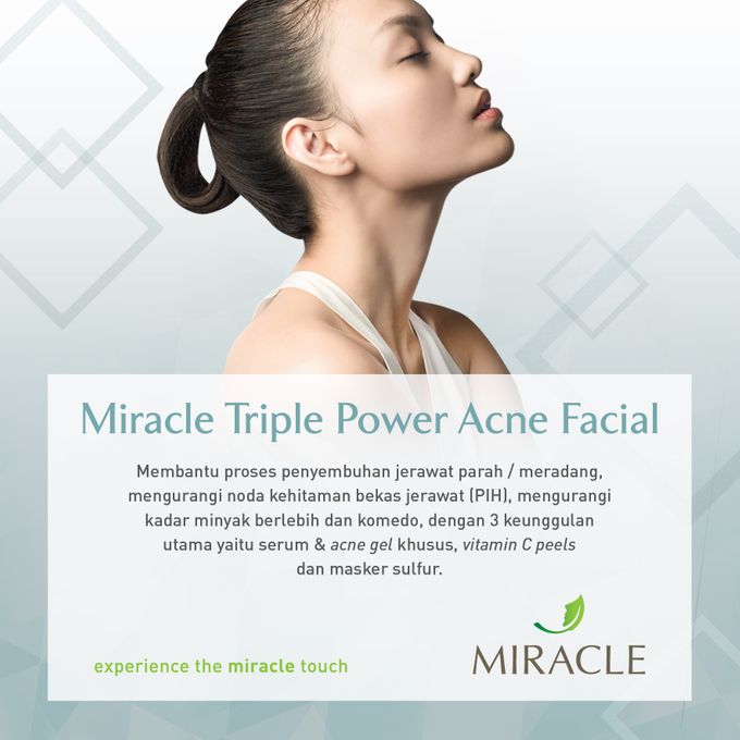 Miracle Prewed BRIGHTENING Package by Miracle Aesthetic Clinic - 007 Miracle Prewed BRIGHTENING Package by Miracle Aesthetic Clinic - 007